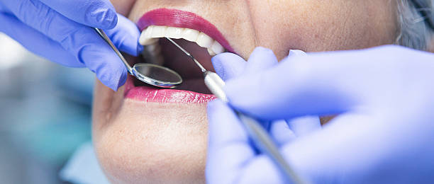 Best Root Canal Emergency Dentist  in Clayton, MO